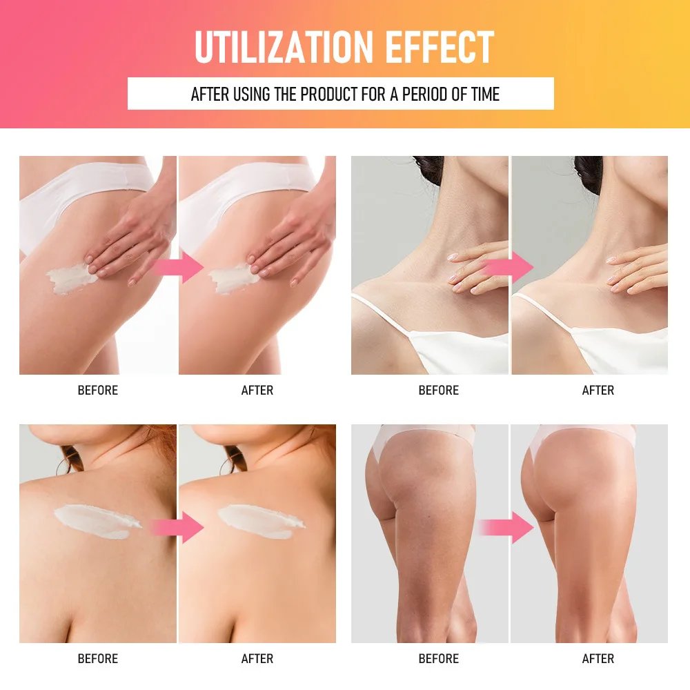 Hip Buttock Care Cream Moisturizing Hip Buttock Care Cream Moisturizing
