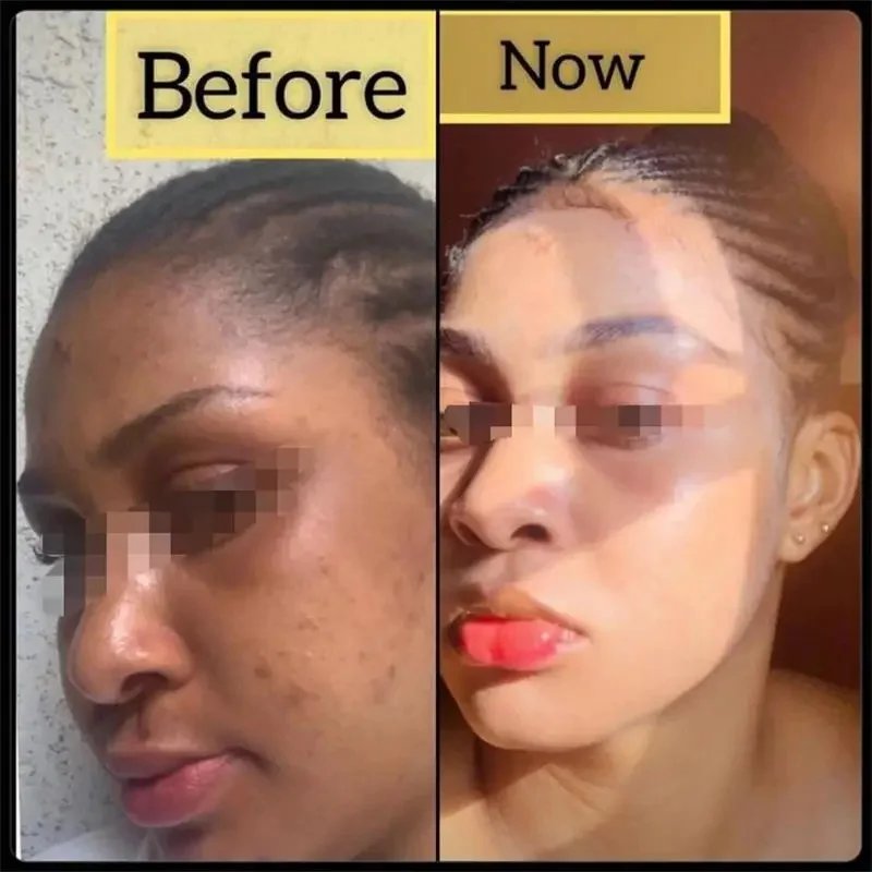 Body Whitening Soap Deep Clean Skin