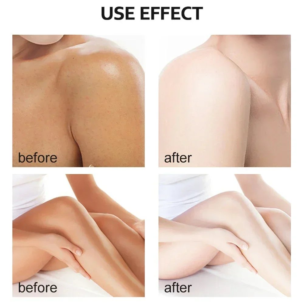 Yellow Peeling Oil Exfoliating Bleaching Dark Skin