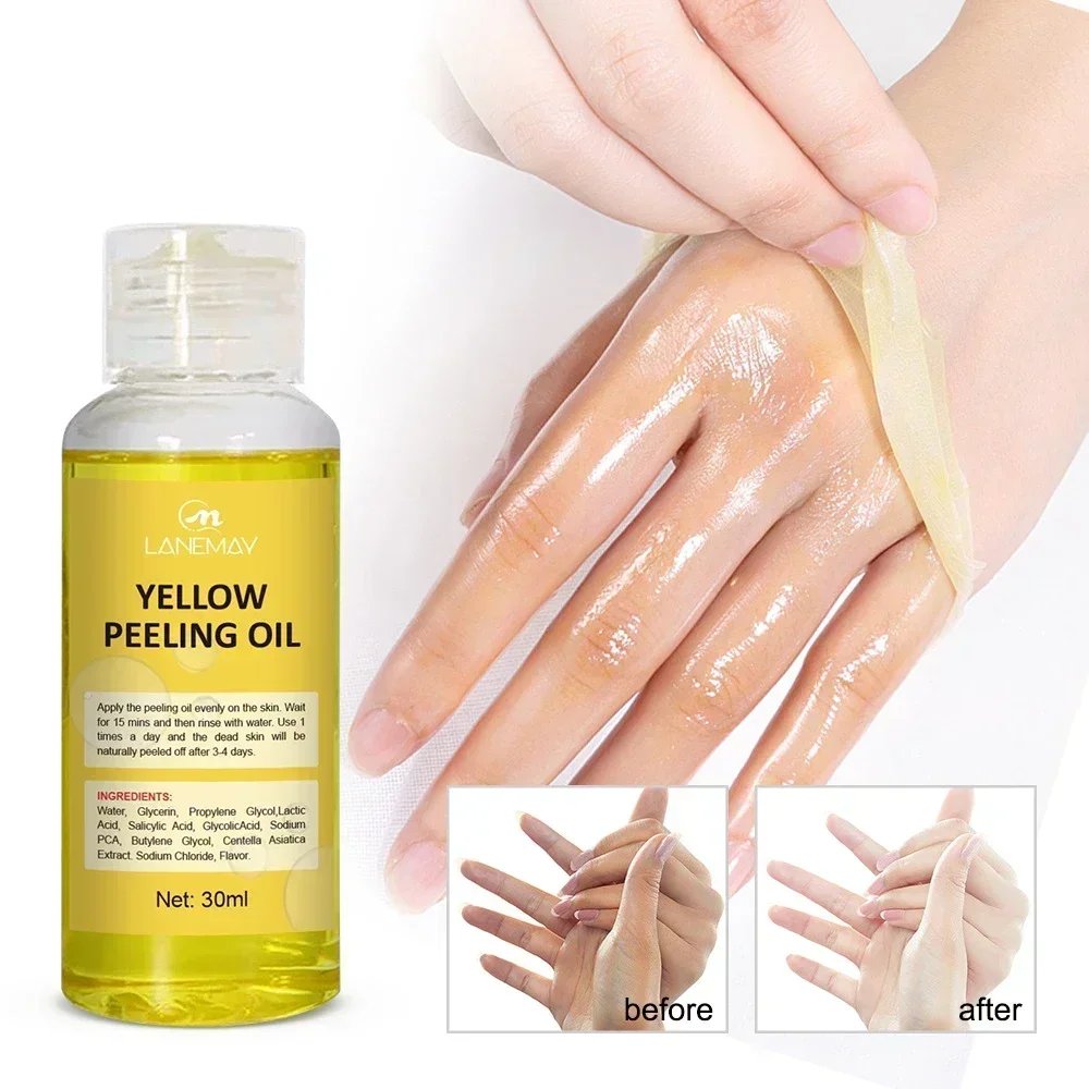Yellow Peeling Oil Exfoliating Bleaching Dark Skin