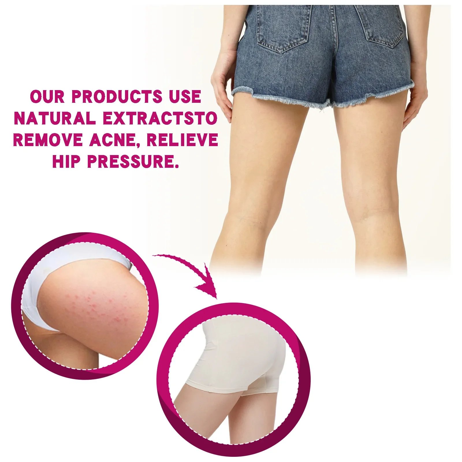 Fade Pimples Moisturize Lotion Butt Inner Thigh Fade Pimples Moisturize Lotion Butt Inner Thigh