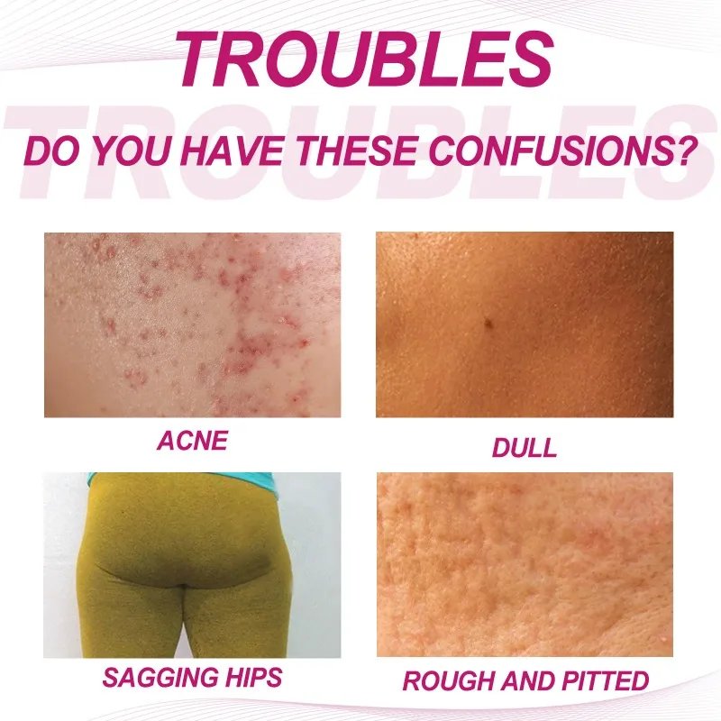 Fade Pimples Moisturize Lotion Butt Inner Thigh - Image 2