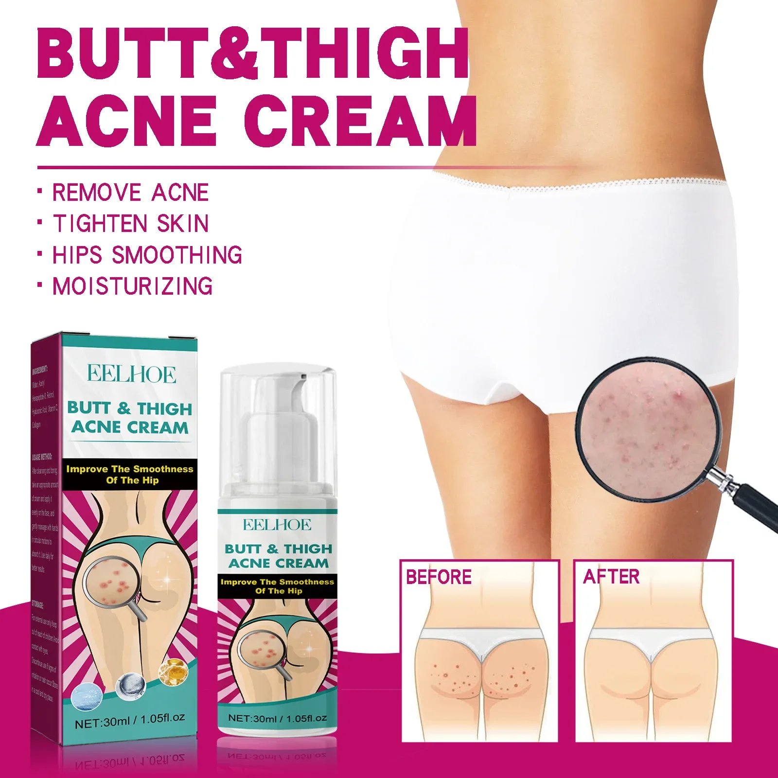 Fade Pimples Moisturize Lotion Butt Inner Thigh Fade Pimples Moisturize Lotion Butt Inner Thigh