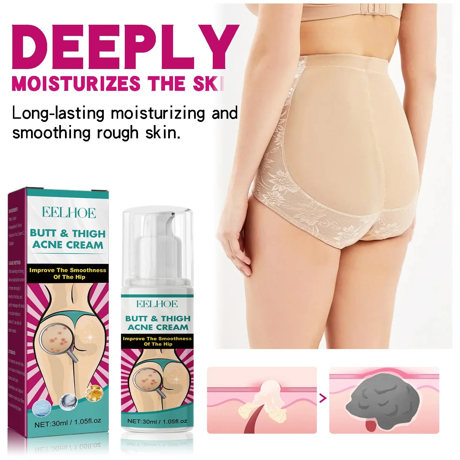 Fade Pimples Moisturize Lotion Butt Inner Thigh Fade Pimples Moisturize Lotion Butt Inner Thigh