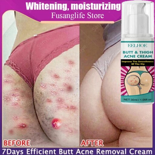 Fade Pimples Moisturize Lotion Butt Inner Thigh
