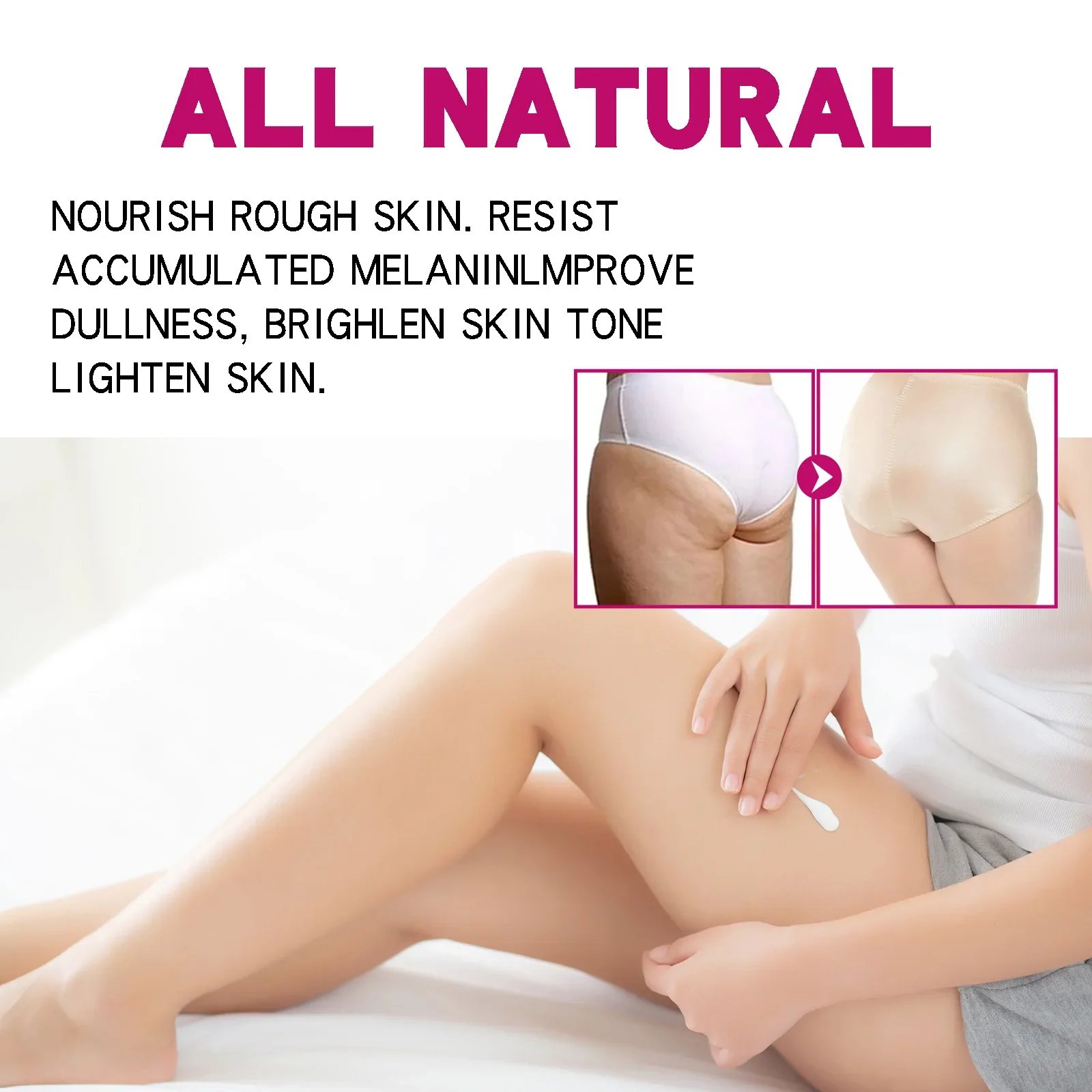 Fade Pimples Moisturize Lotion Butt Inner Thigh Fade Pimples Moisturize Lotion Butt Inner Thigh