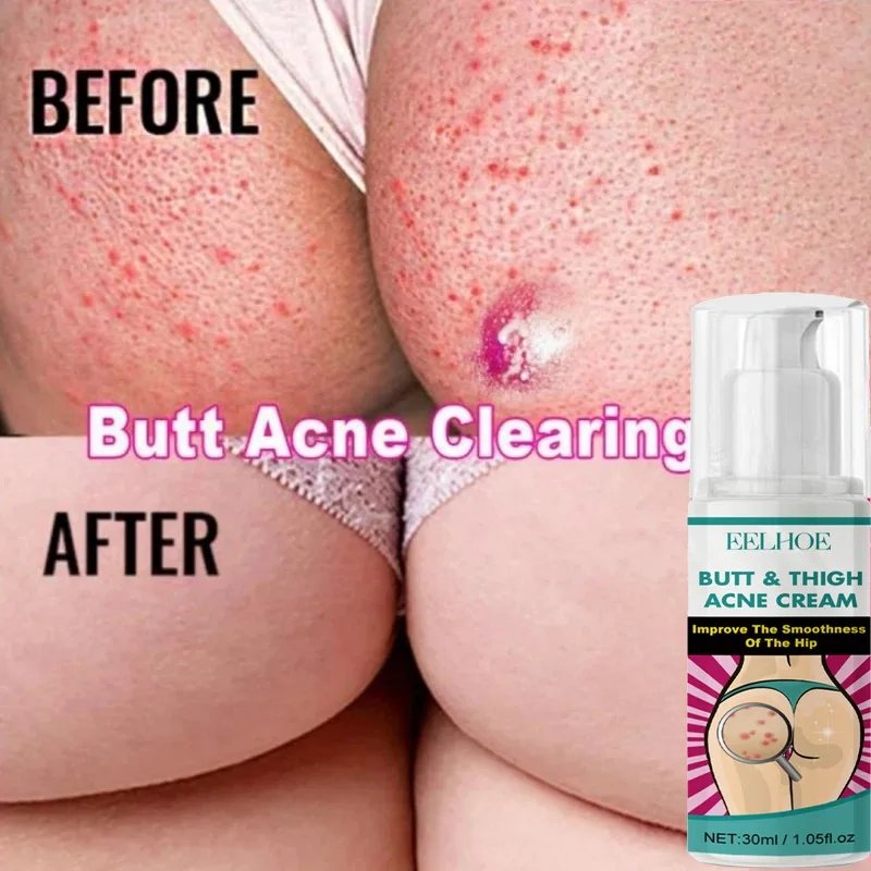 Fade Pimples Moisturize Lotion Butt Inner Thigh - Image 5