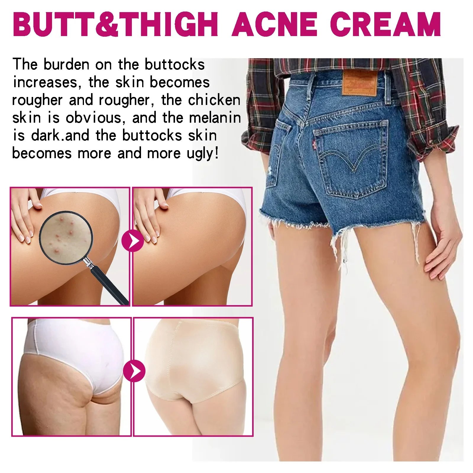 Fade Pimples Moisturize Lotion Butt Inner Thigh Fade Pimples Moisturize Lotion Butt Inner Thigh