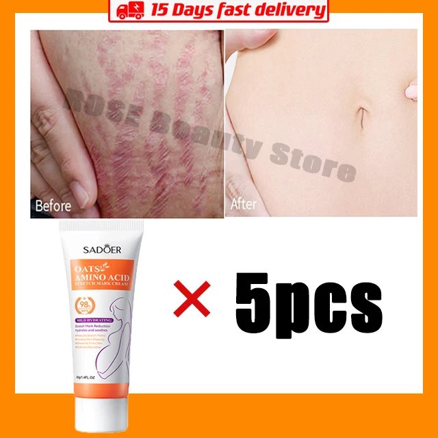 5pcs