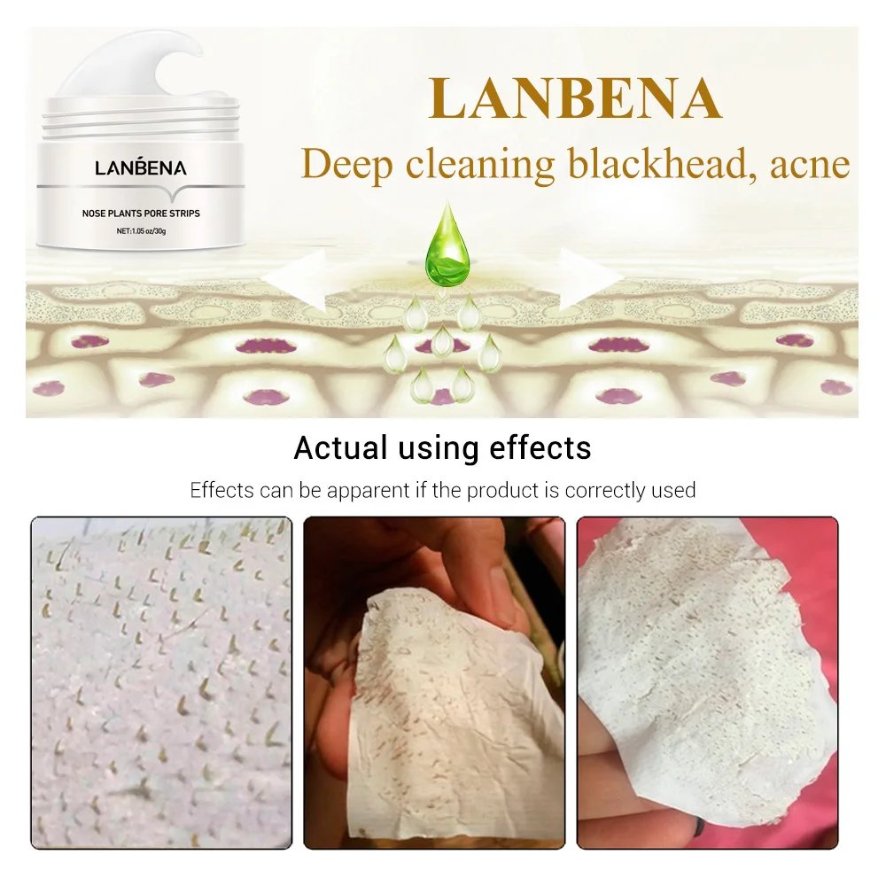 Mask Peeling Anti Acne Treatment