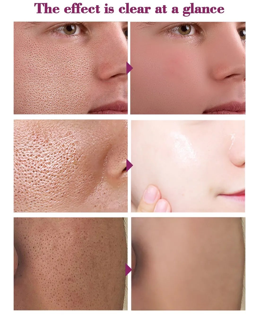 Pore ​​Shrinking Essence Face Repair