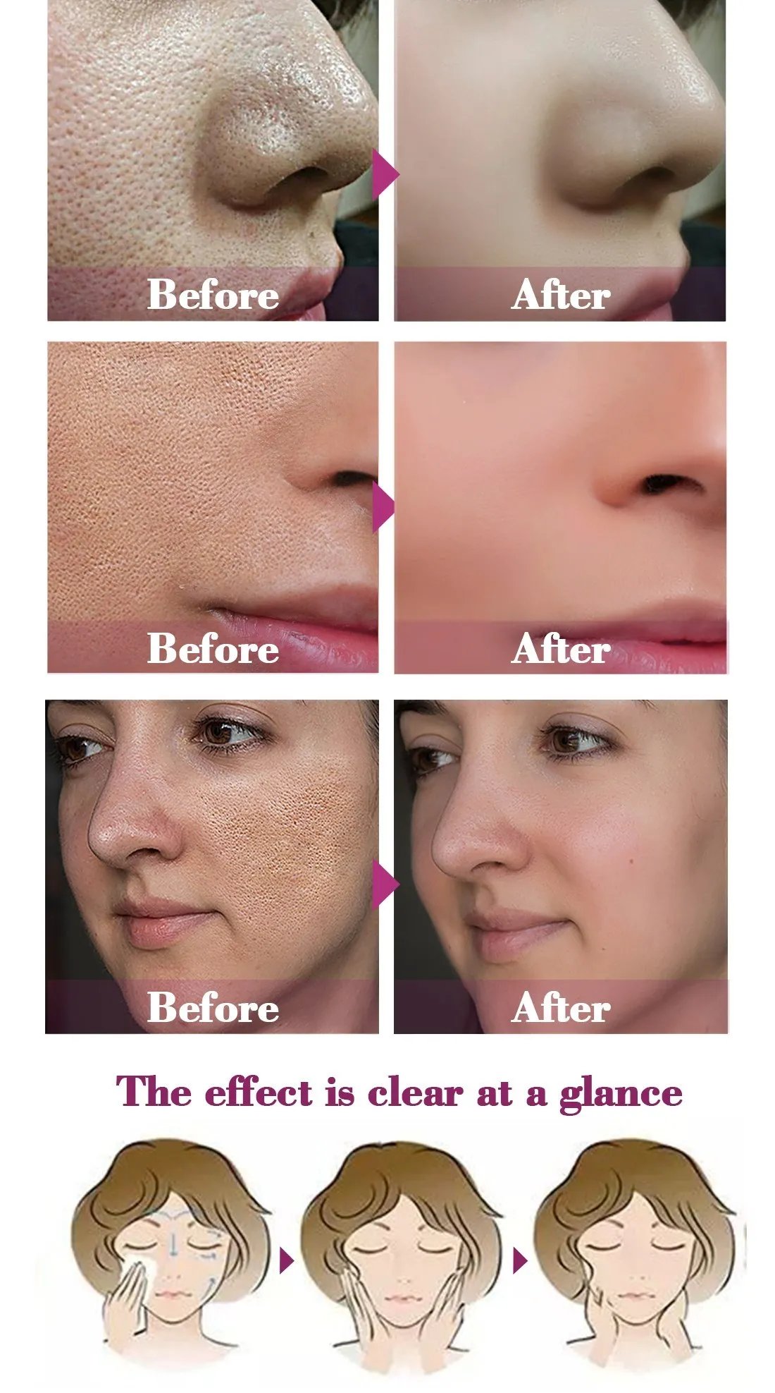 Pore ​​Shrinking Essence Face Repair