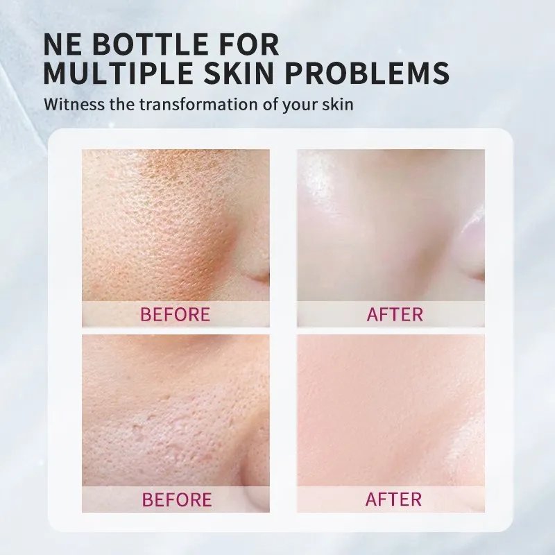 Pore Shrinking Essence Face Repair - Image 6