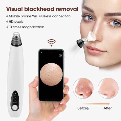 Wireless Camera Visual Blackhead Remover