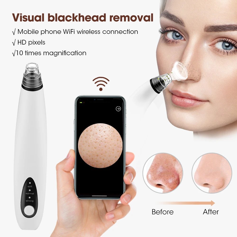 Wireless Camera Visual Blackhead Remover