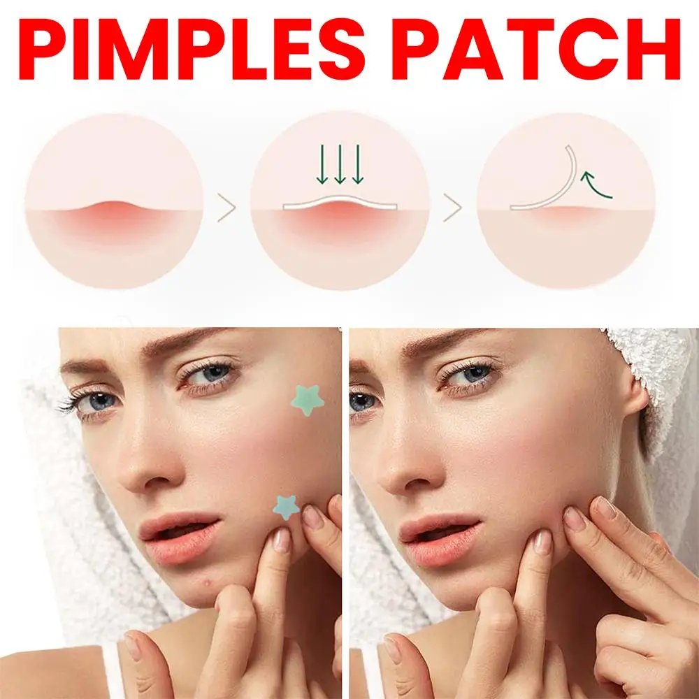 200pcs Star Shape Pimple Patches Colorful
