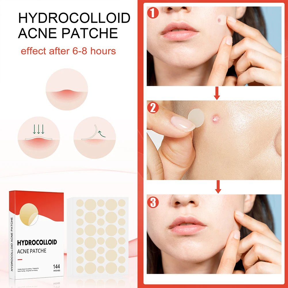 144pcs/set Face Skin Care Acne Pimple Patch