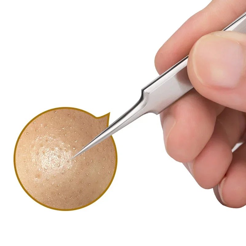 Special blackhead remover Acne Needle Tool